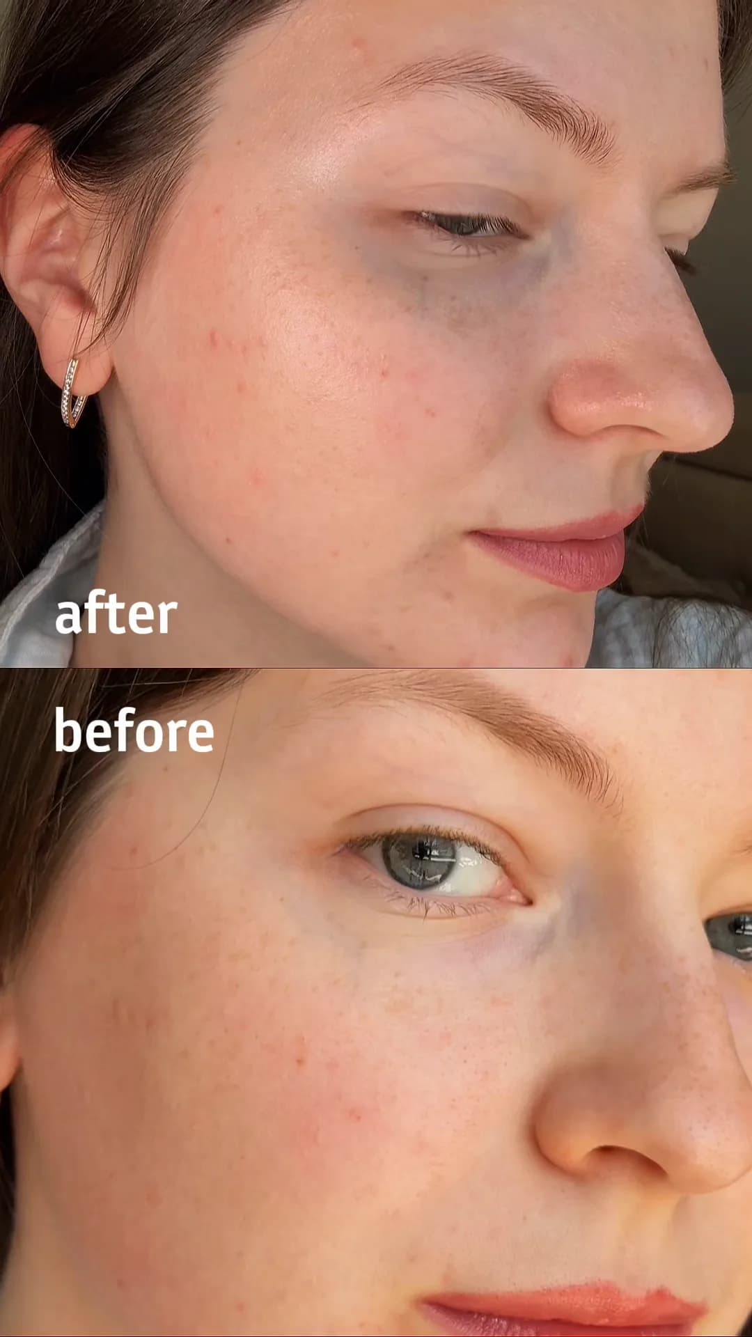 Skincare cover